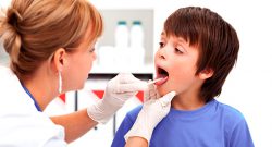 Homeopathy for tosillitis